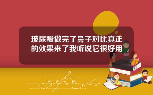玻尿酸做完了鼻子对比真正的效果来了我听说它很好用